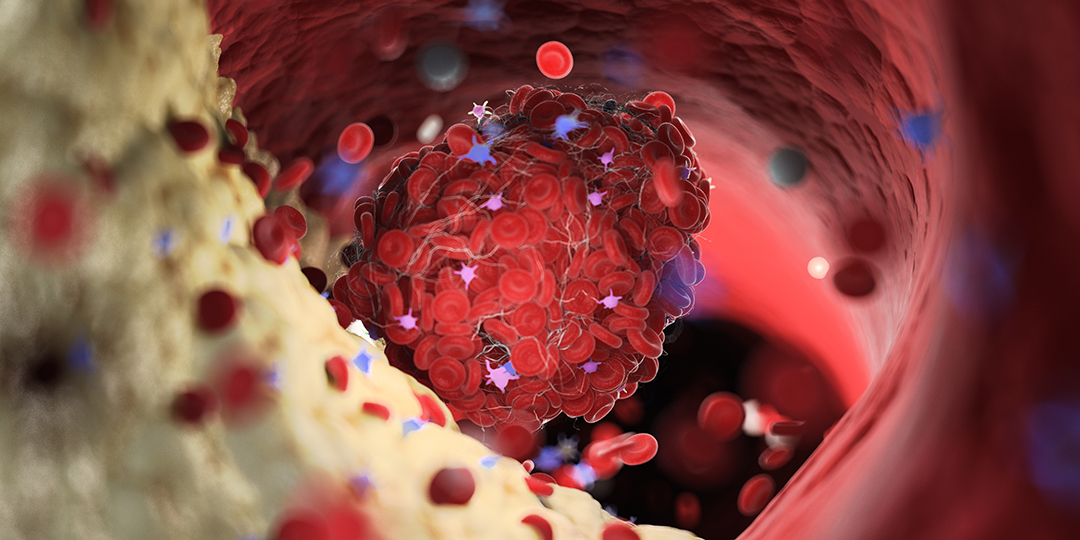 El colesterol: ni villano absoluto ni héroe incomprendido ¡Cuidado con los extremos!
