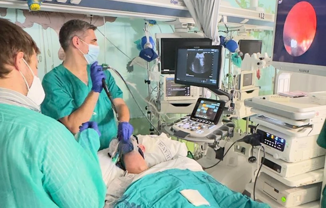 El Hospital San Juan de Dios avanza en la detección precoz del cáncer de pulmón con la incorporación de la ecobroncoscopia