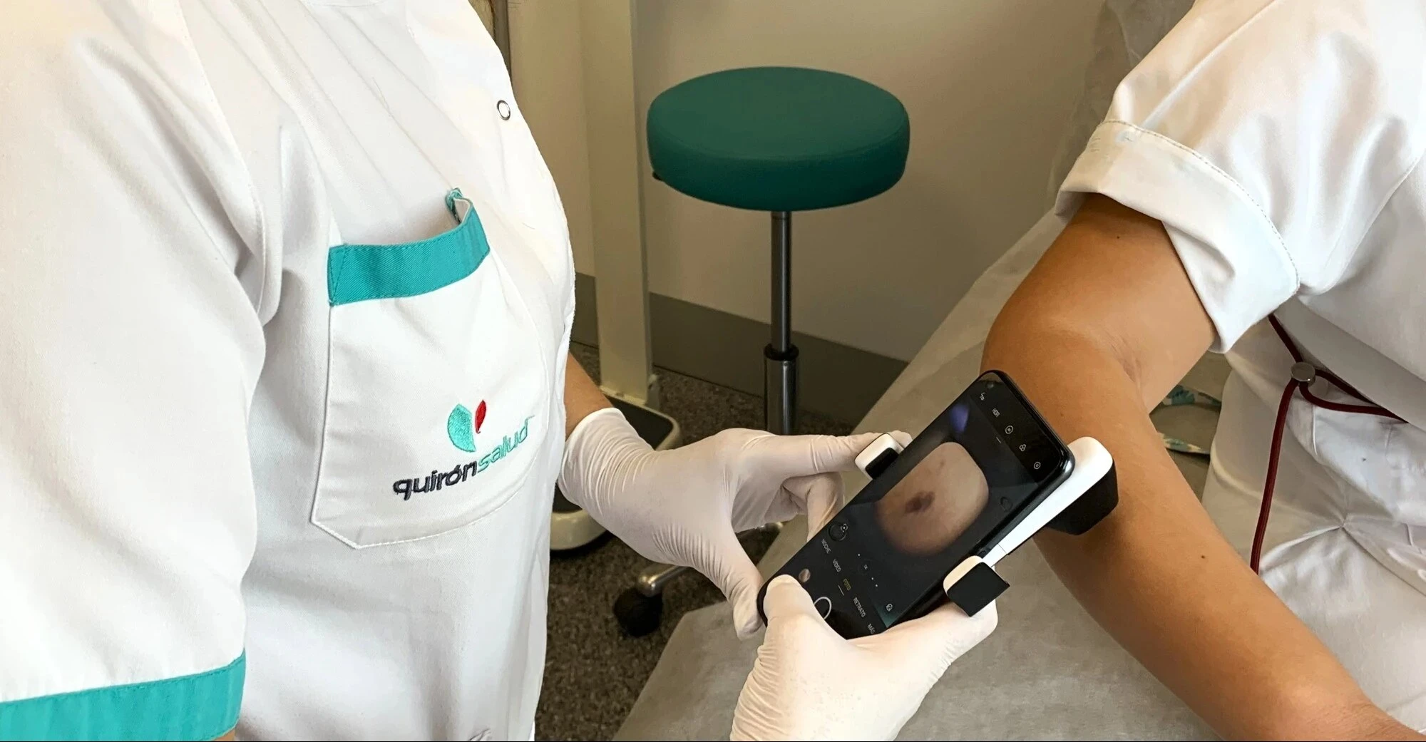 La protección solar y detección precoz, claves contra el cáncer de piel